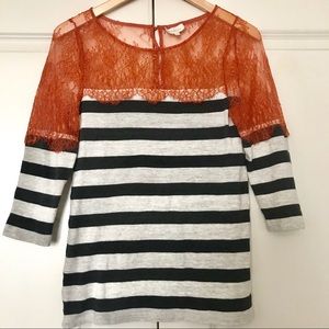 Deletta✨ Lace & Stripped Top